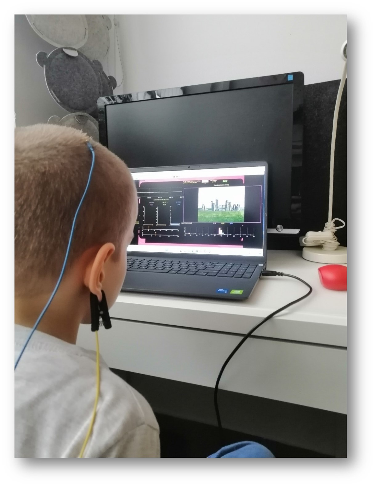 terapia EEG Biofeedback